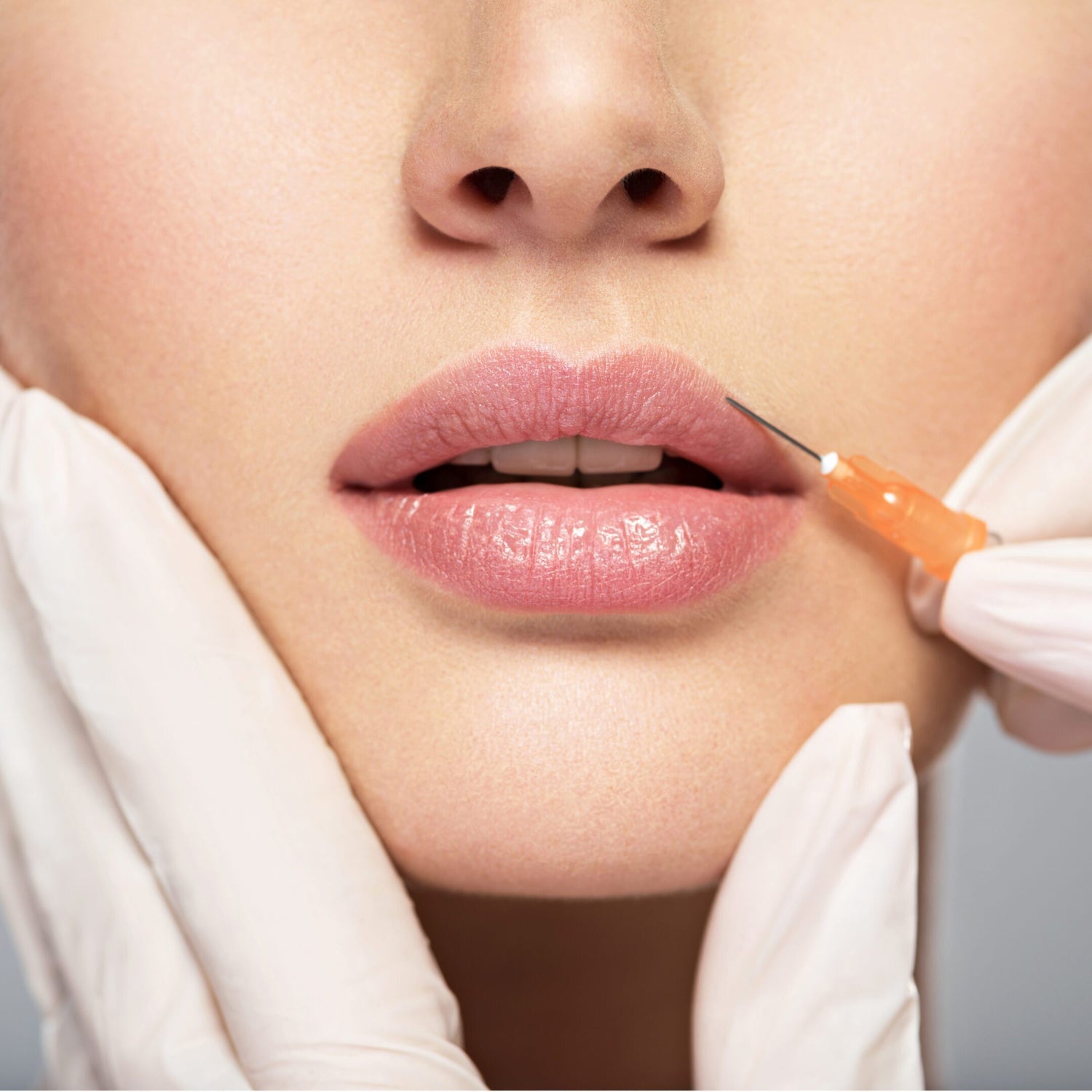 Patient receiving cosmetic lip filler injection